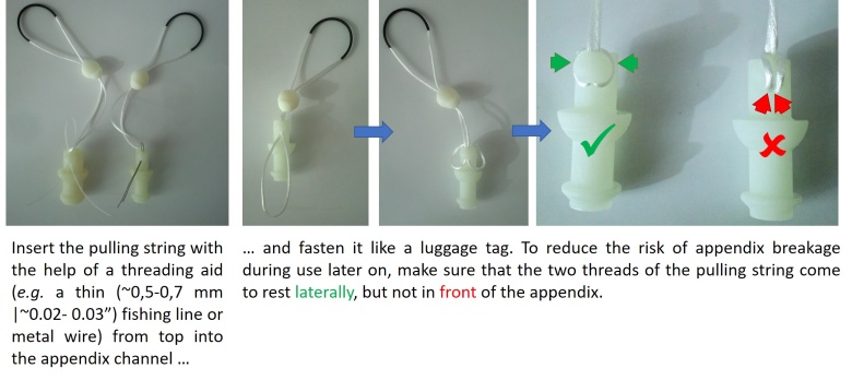 DIY Repairs · Find tips and tricks how to get your foreGestalt companion back in shape 4 DIY Repairs · Find tips and tricks how to get your foreGestalt companion back in shape 3